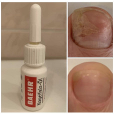 Регенерувальна олія Baehr із паростками пшениці для догляду за нігтями та шкірою Nagelfalz-Öl, 7 мл